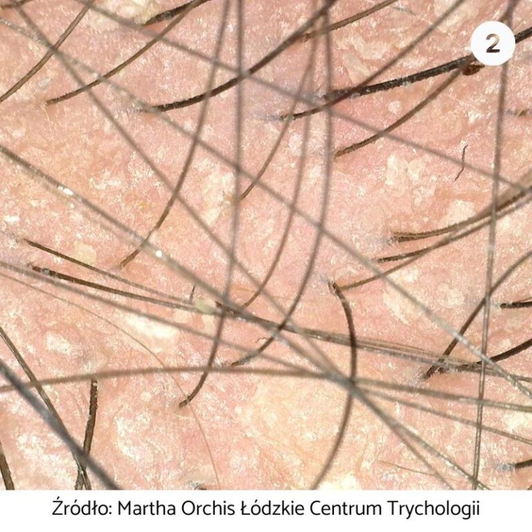 Skóra – odkryj tajemnice wykonawcy i fascynujące ciekawostki o piosence