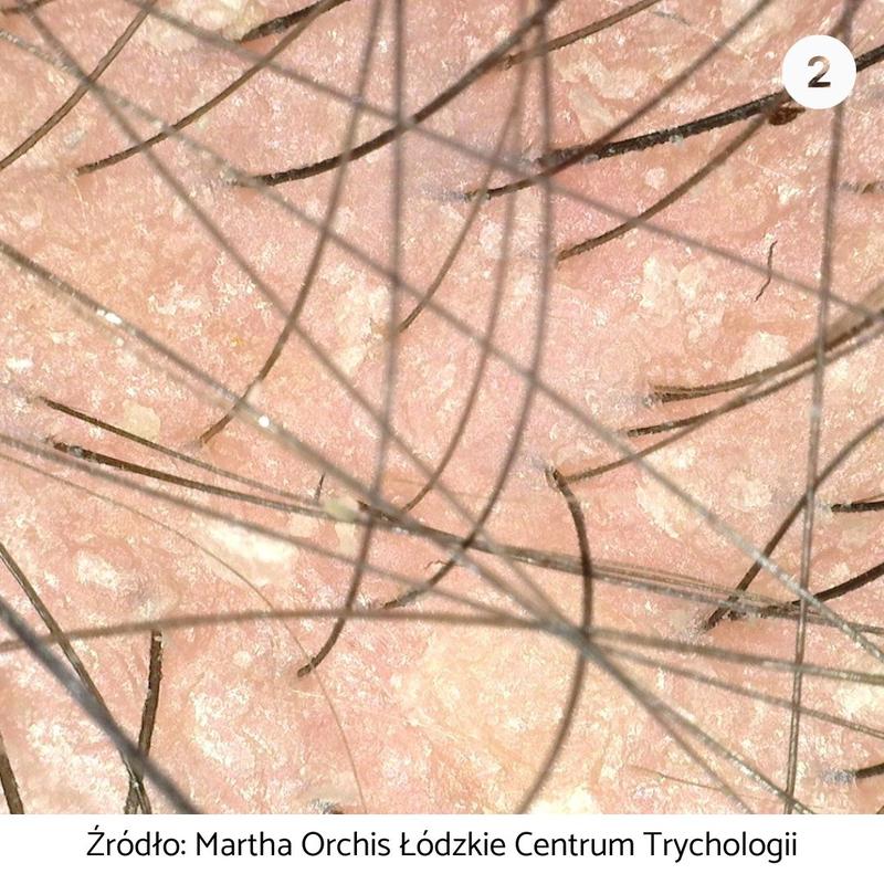 Skóra – odkryj tajemnice wykonawcy i fascynujące ciekawostki o piosence